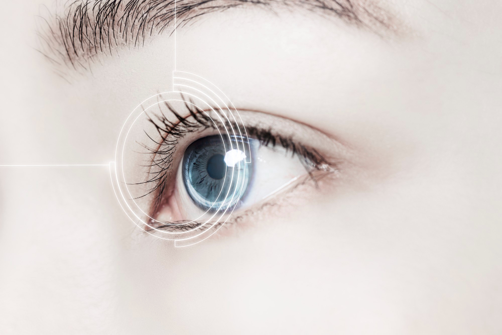 What is LASIK Surgery