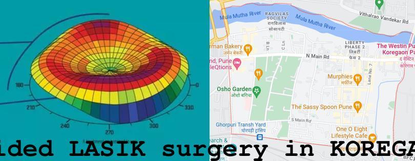 Topo-guided LASIK surgery in Koregaon Park